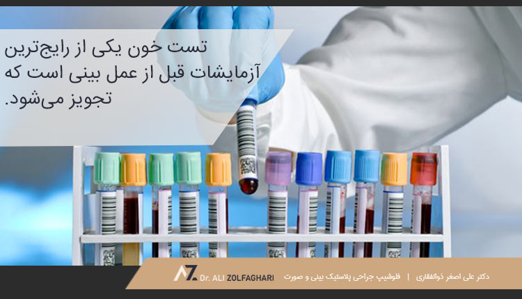 آزمایش خون قبل از عمل بینی