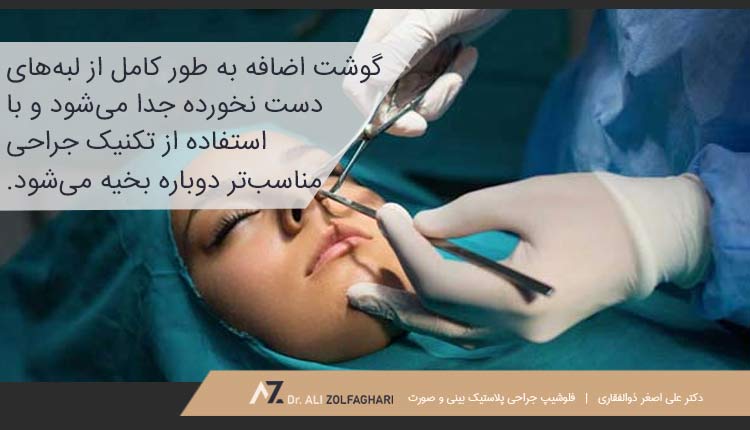 برداشتن کامل گوشت اضافه و بخیه مجدد