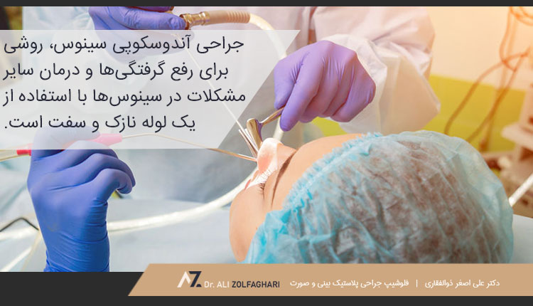 جراحی آندوسکوپی بینی و سینوس چیست؟