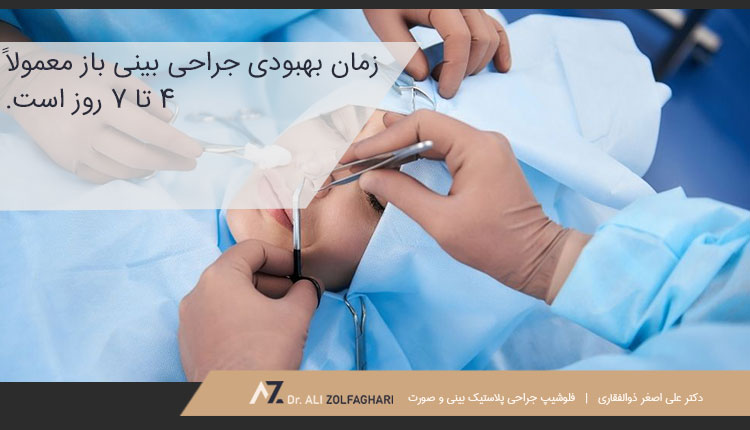 دوره نقاهت رینوپلاستی باز | جراحی بینی به روش باز