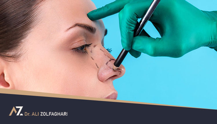 مدت زمان عمل بینی | مدت زمان جراحی زیبایی بینی چند ساعت است؟