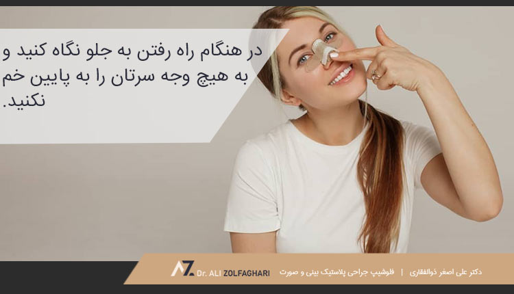 نکات مهم مربوط به راه رفتن بعد از عمل بینی