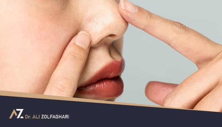 تاثیر عمل بینی بر پوست صورت | بهترین و بدترین نوع پوست