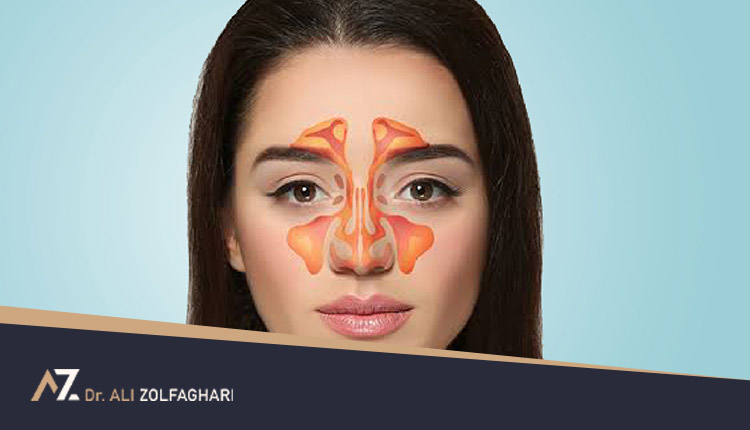 جراحی آندوسکوپی بینی چیست؟ | هزینه جراحی آندوسکوپی بینی
