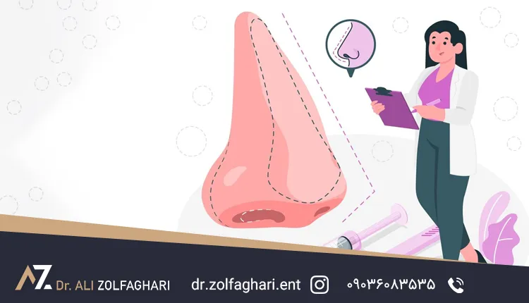 اقدامات لازم پس از ضربه به بینی