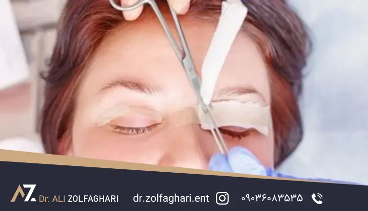 نحوه خوابیدن بعد از عمل بلفاروپلاستی و روش‌های آن