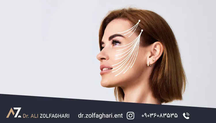 لیفت اندوسکوپیک