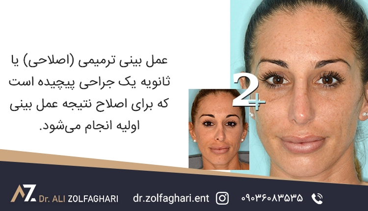 عمل بینی ترمیمی چیست؟