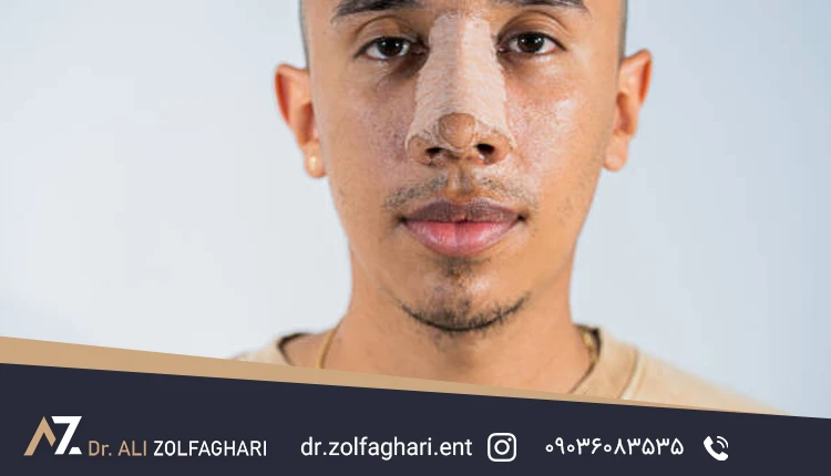 تأثیر بر تناسب اجزای صورت