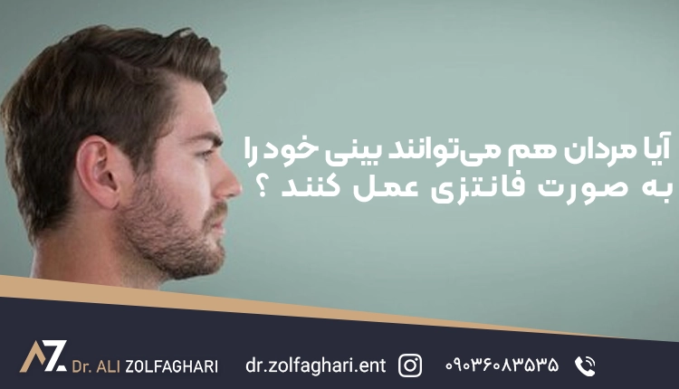 نکات انتخاب فرم با توجه به صورت