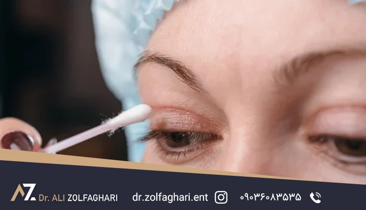 تفاوت بلفاروپلاستی پلک بالا و پایین چیست؟