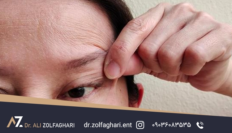 جراحی پلک افتاده 