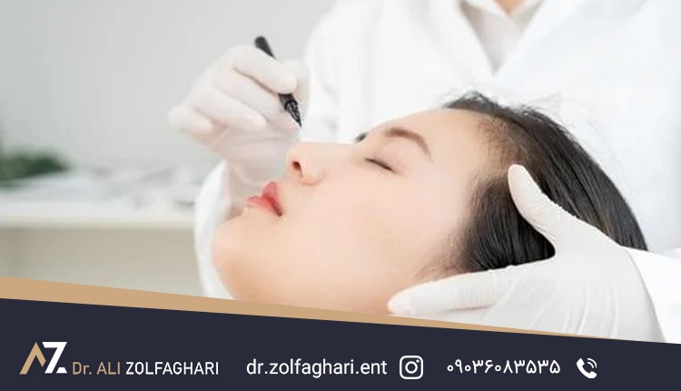 علت افتادگی پلک چیست؟
