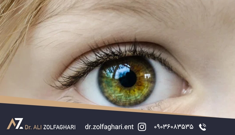 عوامل درمان پتوز در کودکان