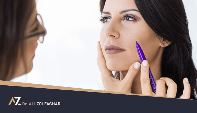 ملاک های انتخاب بهترین متخصص جراحی پلک چیست؟ | بهترین جراح پلک