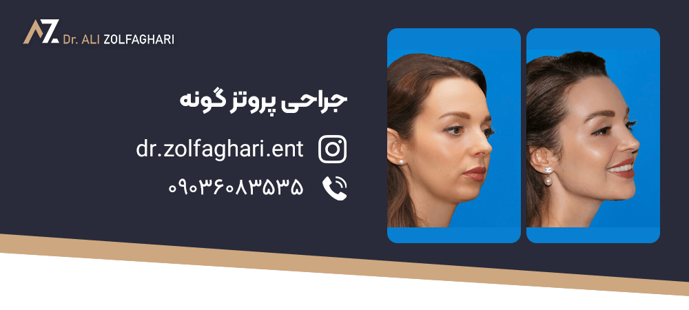 پروتز گونه برای چه کسانی مناسب است؟