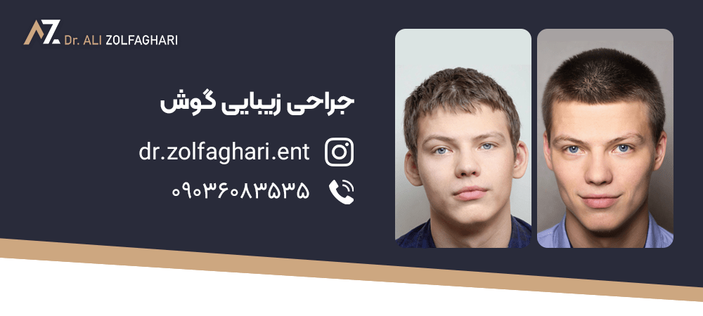 جراحی زیبایی گوش