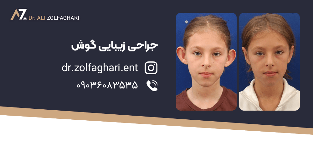 جراحی زیبایی گوش