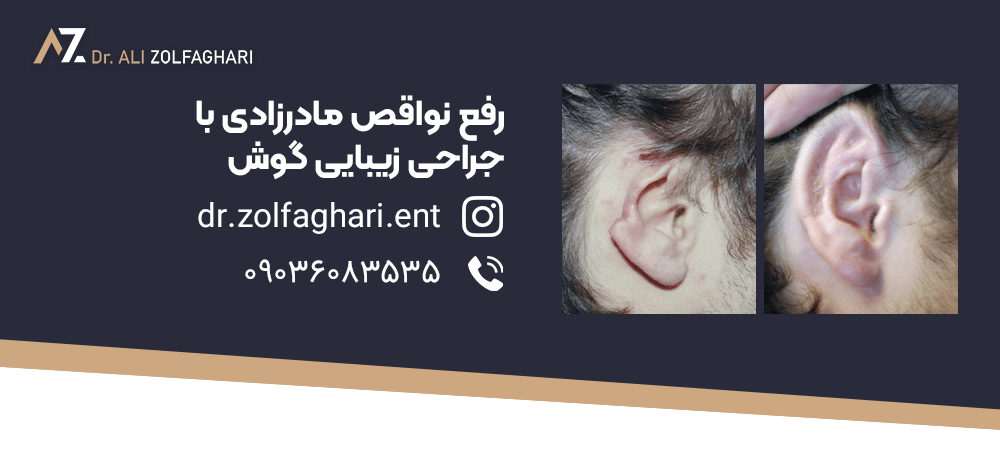 جراحی زیبایی گوش