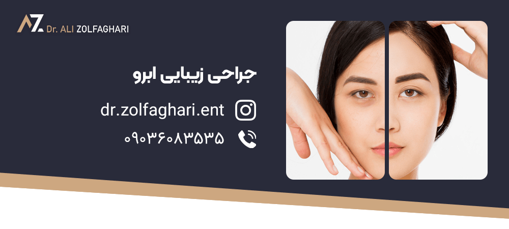 هزینه جراحی لیفت ابرو