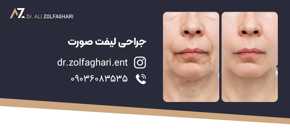 دلایل انجام جراحی لیفت صورت چیست؟