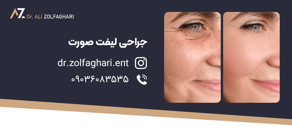 بهترین سن برای لیفت صورت چه زمانی است؟