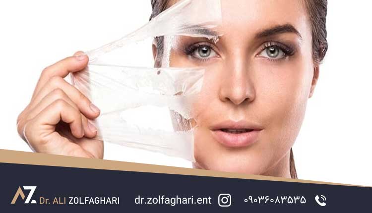  اصلاح صورت بعد از عمل بینی