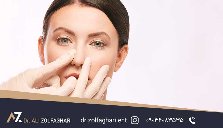 بررسی علل جابجایی غضروف بینی بعد از عمل