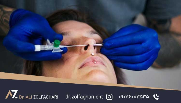 آیا پیرسینگ بعد از جراحی زیبایی بینی امکان پذیر است؟