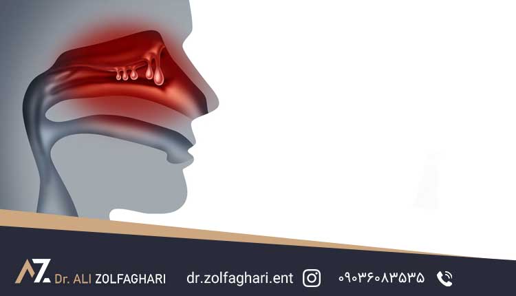 علت چرکی شدن سینوس ها چیست؟
