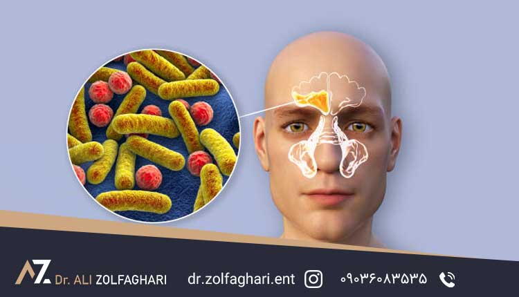 علت چرکی شدن سینوس ها چیست؟