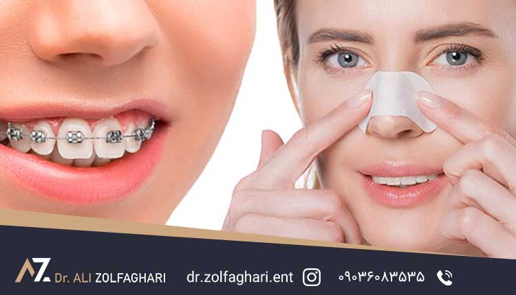 جراحی زیبایی بینی و ارتودنسی