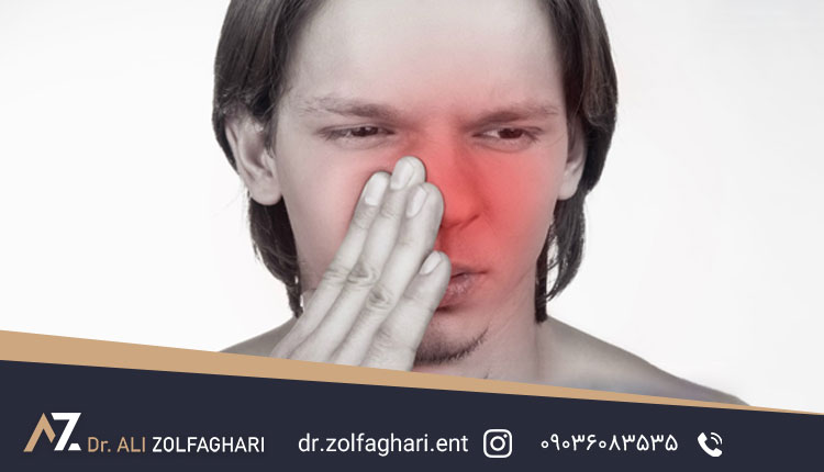 بینی منگنه ای یا کلیپسی