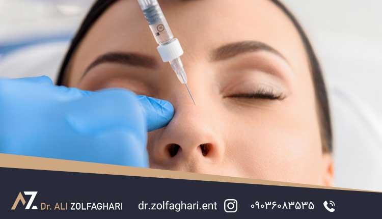 بررسی علل جابجائی غضروف بینی بعد از عمل