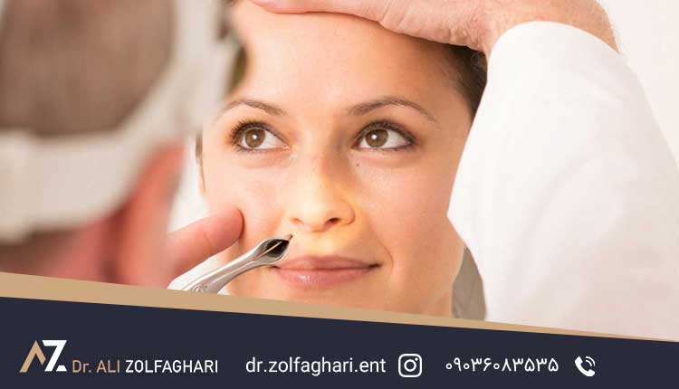 بررسی علل جابجائی غضروف بینی بعد از عمل