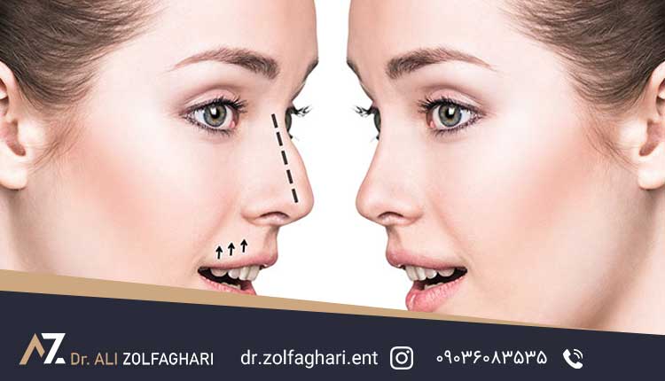 بررسی‌های پیش از جراحی