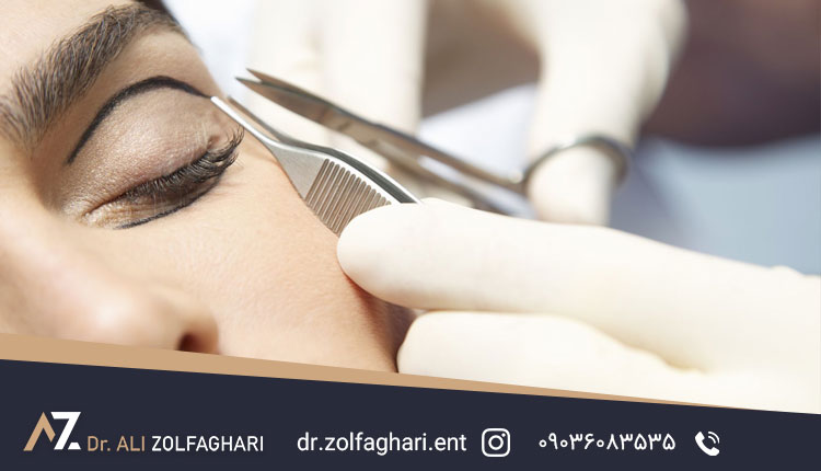 چطور از عوارض عمل بلفاروپلاستی جلوگیری کنیم؟