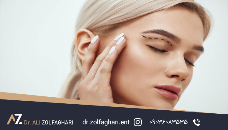چه زمانی بعد جراحی پلک میتوان عمل ترمیمی پلک را انجام داد؟