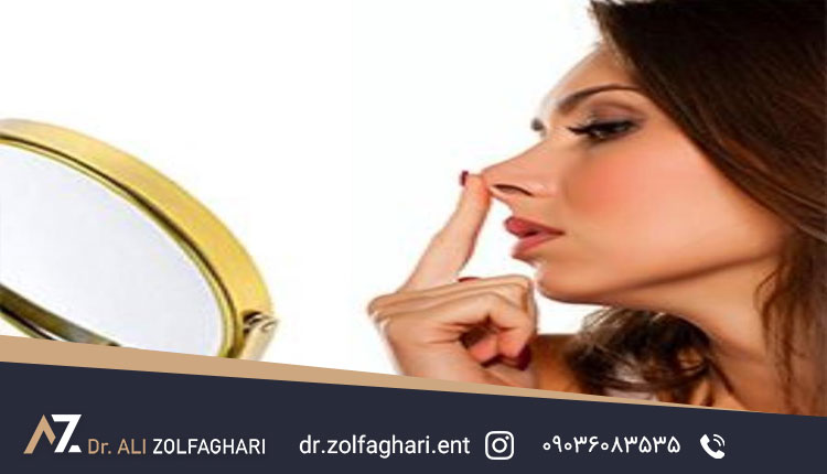 10 دلیل پشیمانی بعد از عمل بینی