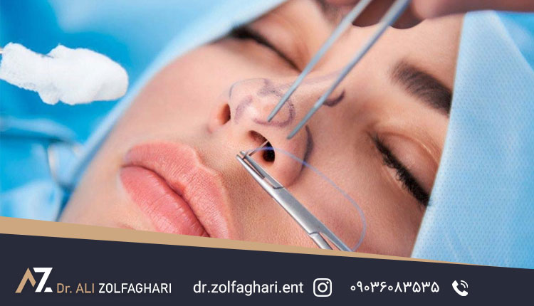 انواع بخیه‌های عمل رینوپلاستی