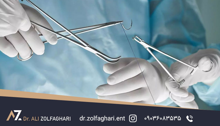 انواع بخیه‌های عمل رینوپلاستی