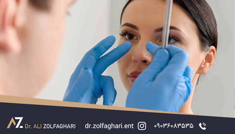 سوالاتی که باید قبل از جراحی بینی از خود بپرسید