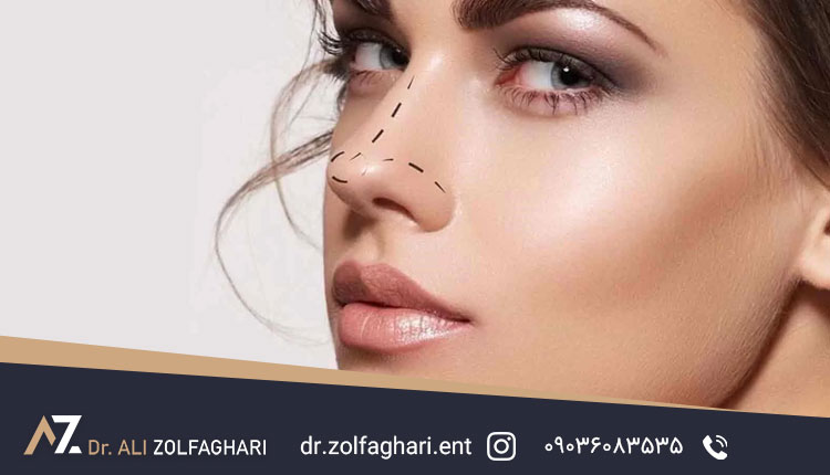 آیا باید نگران استئوتومی در جراحی بینی باشم؟