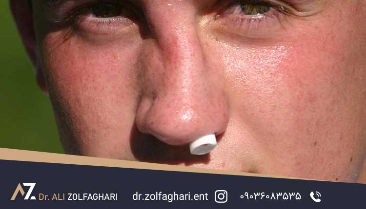 ارزیابی اولیه | نیاز به عمل بینی