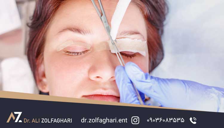 باز ماندن چشم بعد از جراحی بلفاروپلاستی