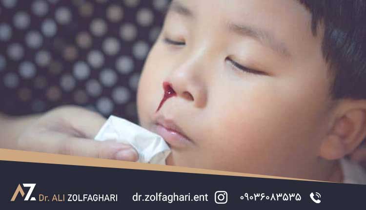 علائم وجود جسم خارجی در بینی کودکان