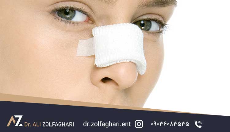 هزینه جراحی بینی عروسکی