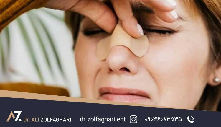 5 عامل موثر در سوزش چشم بعد از عمل بینی