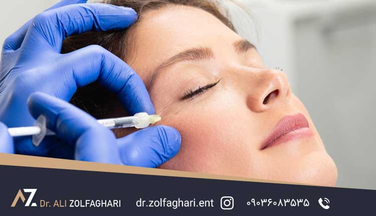 فیلر های کالماریل | لیفت صورت یا فیلر