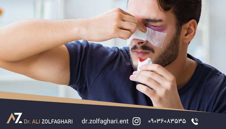 سوء تفاهم از اهداف جراحی بینی یک بیمار